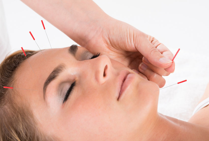 facial rejuvenation acupuncture in sydney